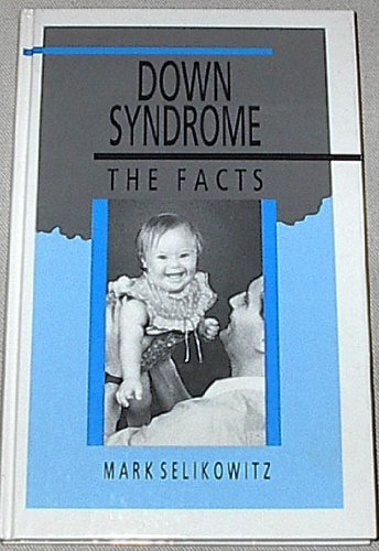 Beispielbild fr Down Syndrome : The Facts zum Verkauf von Better World Books