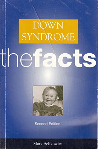 Beispielbild fr Down Syndrome : The Facts zum Verkauf von Better World Books