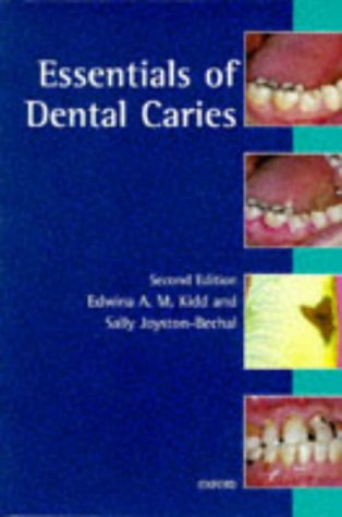 9780192626912: Essentials of Dental Caries: The Disease and Its Management