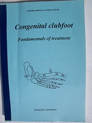 9780192627650: Congenital Clubfoot: Fundamentals of Treatment