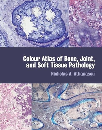 Colour Atlas of Bone, Joint, and Soft Tissue Pathology (9780192627926) by Athanasou, Nicholas A.