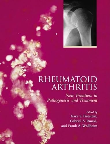 Rheumatoid Arthritis Frontiers in Pathogenesis and Treatment,