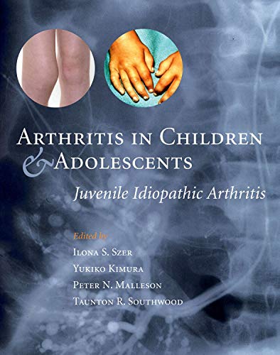 Imagen de archivo de Arthritis in Children and Adolescents: Juvenile Idiopathic Arthritis a la venta por AwesomeBooks