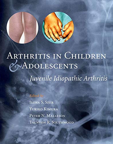 Stock image for Arthritis in Children and Adolescents: Juvenile Idiopathic Arthritis for sale by AwesomeBooks