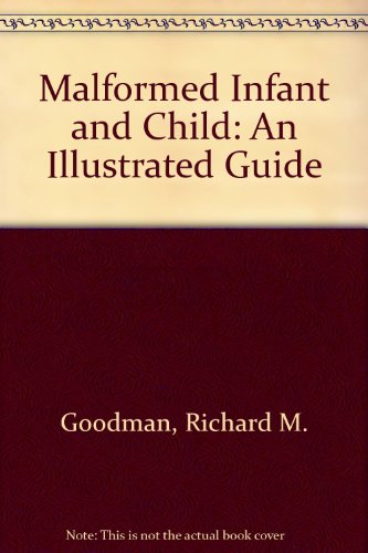 Stock image for Malformed Infant and Child: An Illustrated Guide for sale by Ergodebooks
