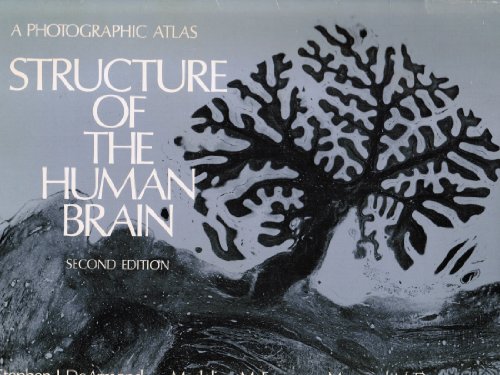 Stock image for Structure of the Human Brain: A Photographic Atlas for sale by ThriftBooks-Atlanta