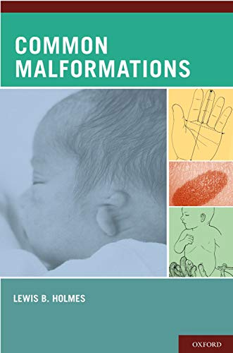 Stock image for Common Malformations for sale by Better World Books
