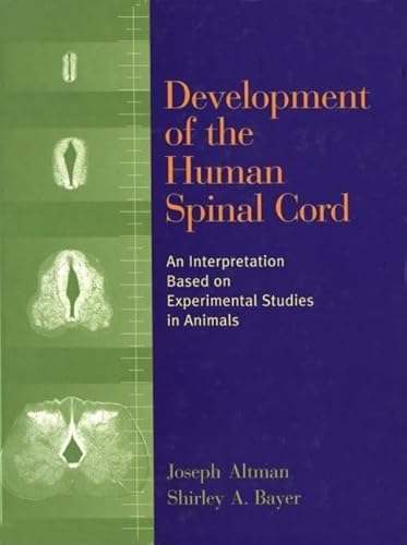 Beispielbild fr Development of the Human Spinal Cord: An Interpretation Based on Experimental Studies in Animals zum Verkauf von Irish Booksellers