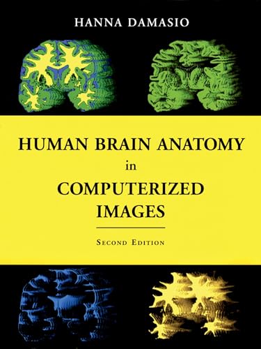 Human Brain Anatomy in Computerized Images (9780195165616) by Damasio M.D., Hanna