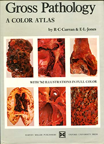 Gross Pathology: A Color Atlas (9780195197976) by Curran, R. C.; Jones, E. L.