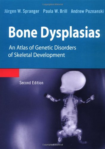 Bone Dysplasias (9780195214741) by Spranger, Jurgen W.; Brill, Paula W.; Poznanski, Andrew K.; Spranger; Freed, Mark; Mason, Pamela; Mehta; Shankie; Nyberg, D.A.; Holzgreve, W.;...