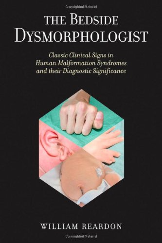 9780195300451: The Bedside Dysmorphologist: Classic Clinical Signs in Human Malformation Syndromes and their Diagnostic Significance