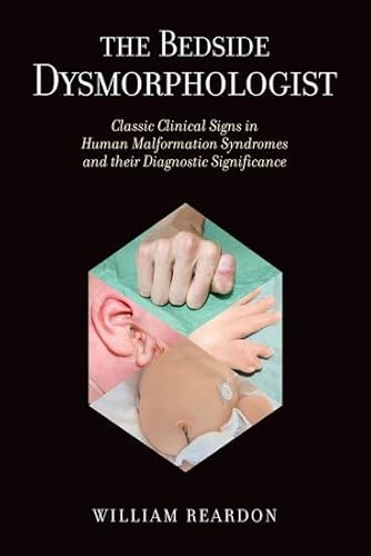 Imagen de archivo de The Bedside Dysmorphologist: Classic Clinical Signs in Human Malformation Syndromes and their Diagnostic Significance a la venta por WYEMART LIMITED