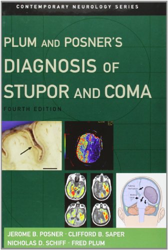 Beispielbild fr Plum and Posner's Diagnosis of Stupor and Coma (Contemporary Neurology Series, 71) zum Verkauf von HPB-Red