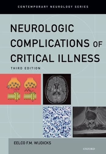 Beispielbild fr Neurologic Complications of Critical Illness (Contemporary Neurology Series) zum Verkauf von HPB-Red
