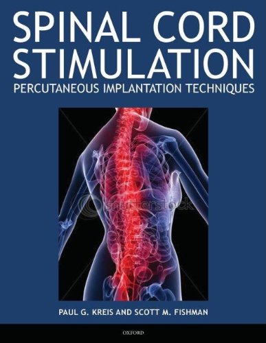 Stock image for Spinal Cord Stimulation: Percutaneous Implantation Techniques for sale by Hawking Books