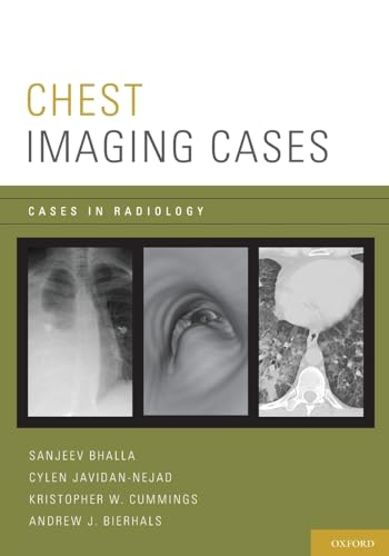 Stock image for Chest Imaging Cases (Cases in Radiology) for sale by HPB-Red