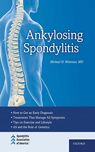 Imagen de archivo de Ankylosing Spondylitis a la venta por Spread The Word Nevada