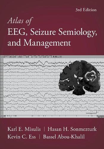 Imagen de archivo de Atlas of EEG, Seizure Semiology, and Management a la venta por Books Unplugged