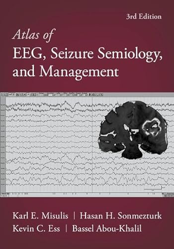 Stock image for Atlas of EEG, Seizure Semiology, and Management for sale by Books Unplugged