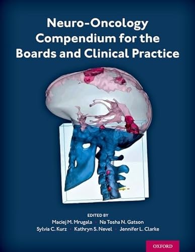 Beispielbild fr Neuro-Oncology Compendium for the Boards and Clinical Practice zum Verkauf von Books From California
