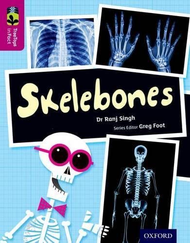 Beispielbild fr Oxford Reading Tree TreeTops inFact: Level 10: Skelebones zum Verkauf von AwesomeBooks