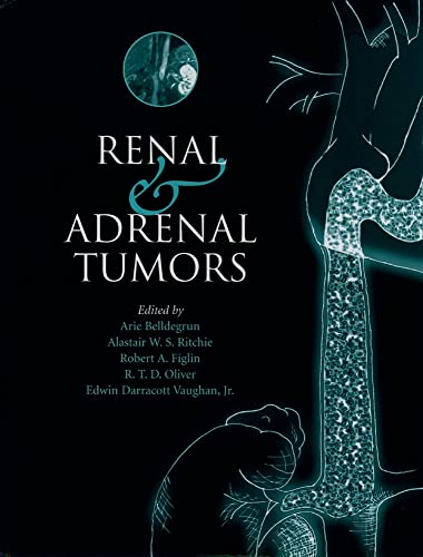 9780198508229: Renal and Adrenal Tumors: Biology and Management