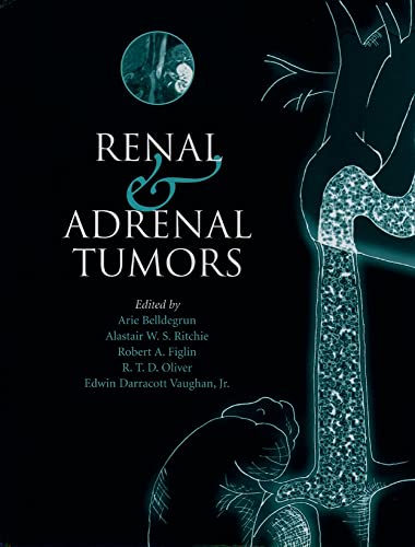 Imagen de archivo de Renal and Adrenal Tumors: Biology and Management a la venta por Phatpocket Limited