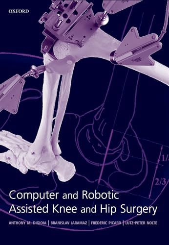 Stock image for Computer and Robotic Assisted Hip and Knee Surgery for sale by ThriftBooks-Dallas