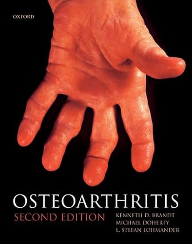 Beispielbild fr Osteoarthritis (Oxford Medical Publications) zum Verkauf von Bellwetherbooks