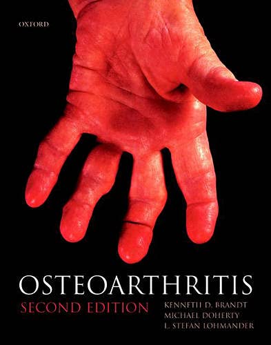 Imagen de archivo de Osteoarthritis (Oxford Medical Publications) a la venta por Bellwetherbooks