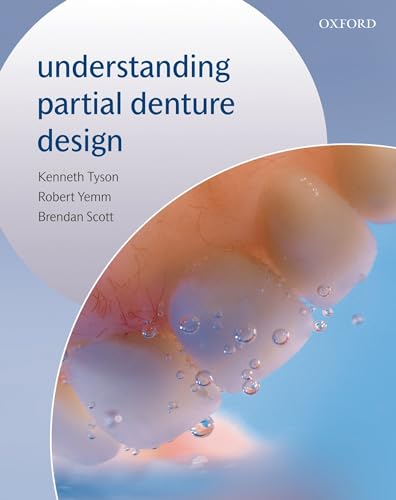Imagen de archivo de Understanding Partial Denture Design a la venta por Brit Books