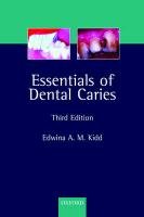 Imagen de archivo de Essentials of Dental Caries : The Disease and Its Management a la venta por Better World Books