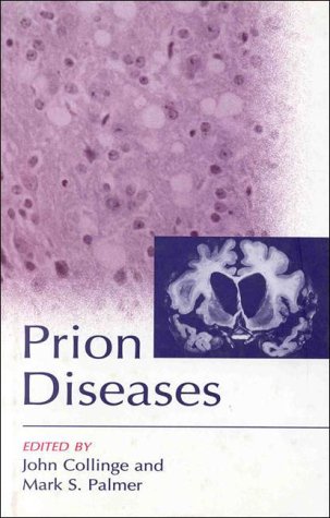 Stock image for Prion Diseases for sale by Anybook.com
