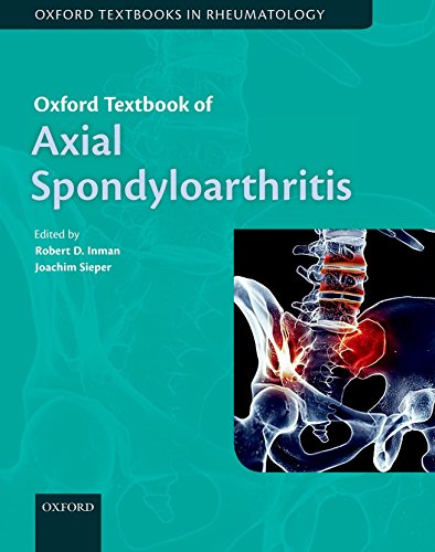 Stock image for Oxford Textbook of Axial Spondyloarthritis (Oxford Textbooks in Rheumatology) for sale by Prior Books Ltd