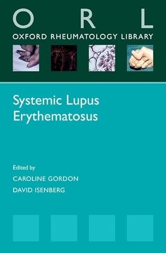 Stock image for Systemic Lupus Erythematosus for sale by Blackwell's