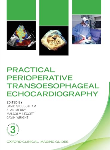 Beispielbild fr Practical Perioperative Transoesophageal Echocardiography zum Verkauf von Blackwell's