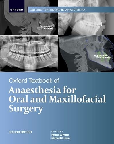 Beispielbild fr Oxford Textbook of Anaesthesia for Oral and Maxillofacial Surgery zum Verkauf von Blackwell's