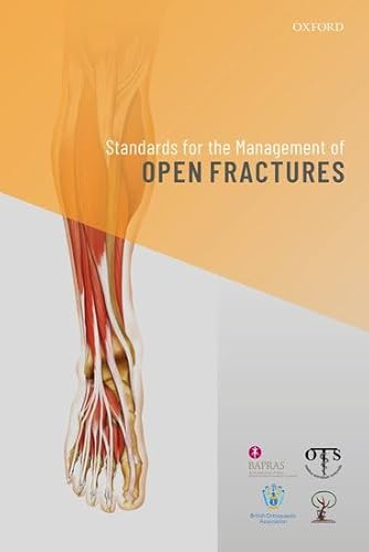9780198849360: Standards for the Management of Open Fractures