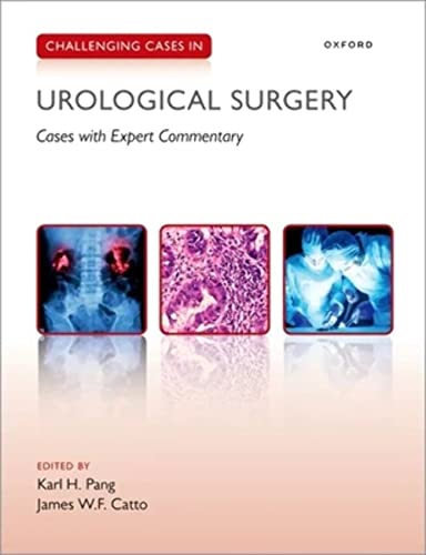 9780198854371: Challenging Cases in Urological Surgery