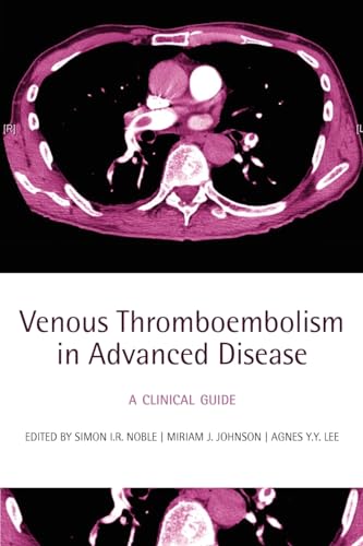 Beispielbild fr VENOUS THROMBOEMBOLISM IN ADVANCED DISEASE: A CLINICAL GUIDE. zum Verkauf von Cambridge Rare Books