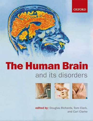 Imagen de archivo de The Human Brain and its Disorders a la venta por WorldofBooks
