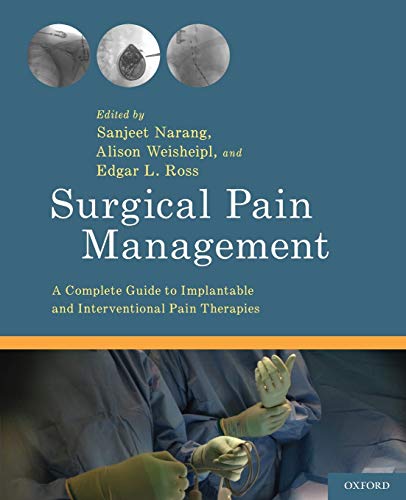 Beispielbild fr Surgical Pain Management: A Complete Guide to Implantable and Interventional Pain Therapies zum Verkauf von GF Books, Inc.