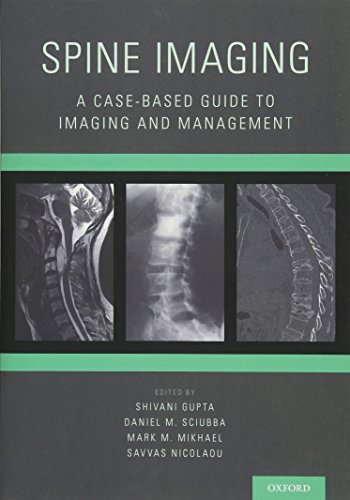 Beispielbild fr Spine Imaging: A Case-Based Guide to Imaging and Management zum Verkauf von BooksRun