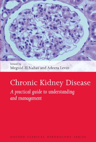 Imagen de archivo de Chronic Kidney Disease : A Practical Guide to Understanding and Management a la venta por Better World Books Ltd