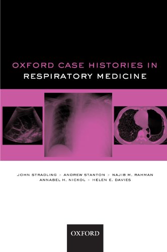 Oxford Case Histories in Respiratory Medicine