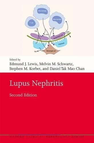 Imagen de archivo de Lupus Nephritis a la venta por Revaluation Books