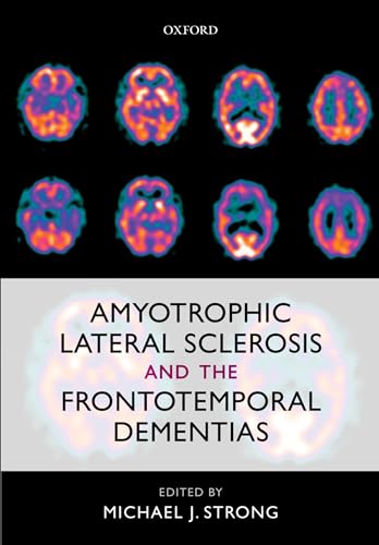 Beispielbild fr Amyotrophic Lateral Sclerosis and the Frontotemporal Dementias zum Verkauf von Powell's Bookstores Chicago, ABAA