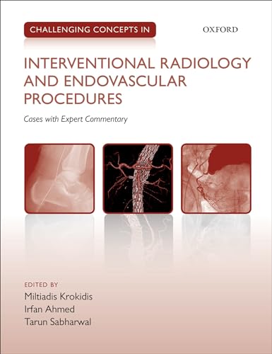 Stock image for Challenging Concepts in Interventional Radiology and Endovascular Procedures for sale by Blackwell's