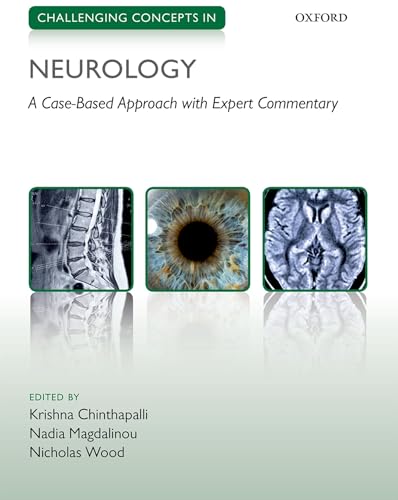 Stock image for Challenging Concepts in Neurology for sale by Blackwell's